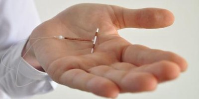 Método contraceptivo DIU é implantado gratuitamente em Araguaína