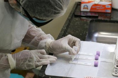 Araguaína realiza mais de 50 mil testes da covid-19