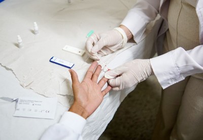 Prefeitura de Araguaína amplia ações contra hepatites virais nas UBS durante mês de agosto